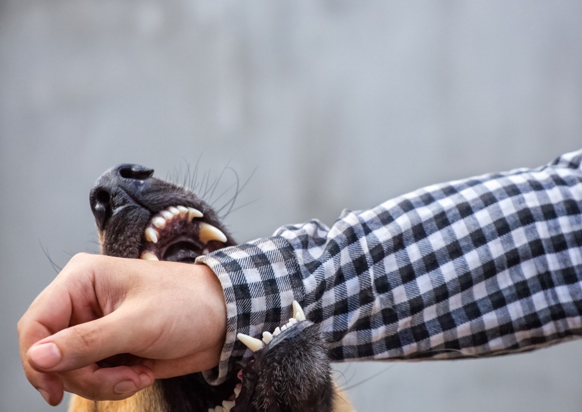 Dog biting a man's arm.