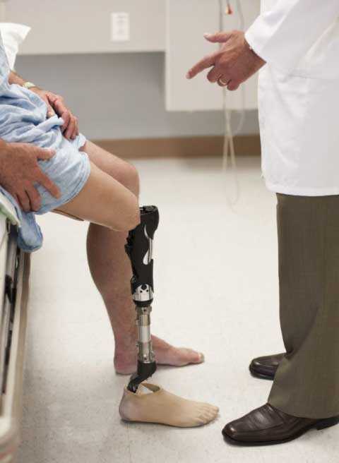 A man with an artificial leg sitting talking to a doctor.